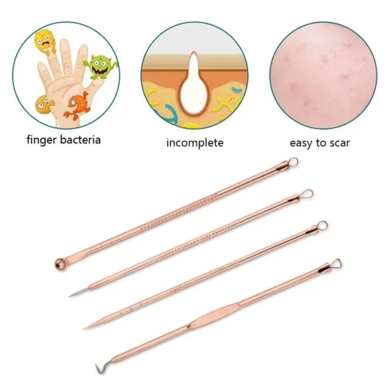 4pcs/set Dual Heads Acne Needle Blackhead Blemish Squeeze Pimple Extractor Remover Spot Cleaner Beauty Skin Care Tool Kit