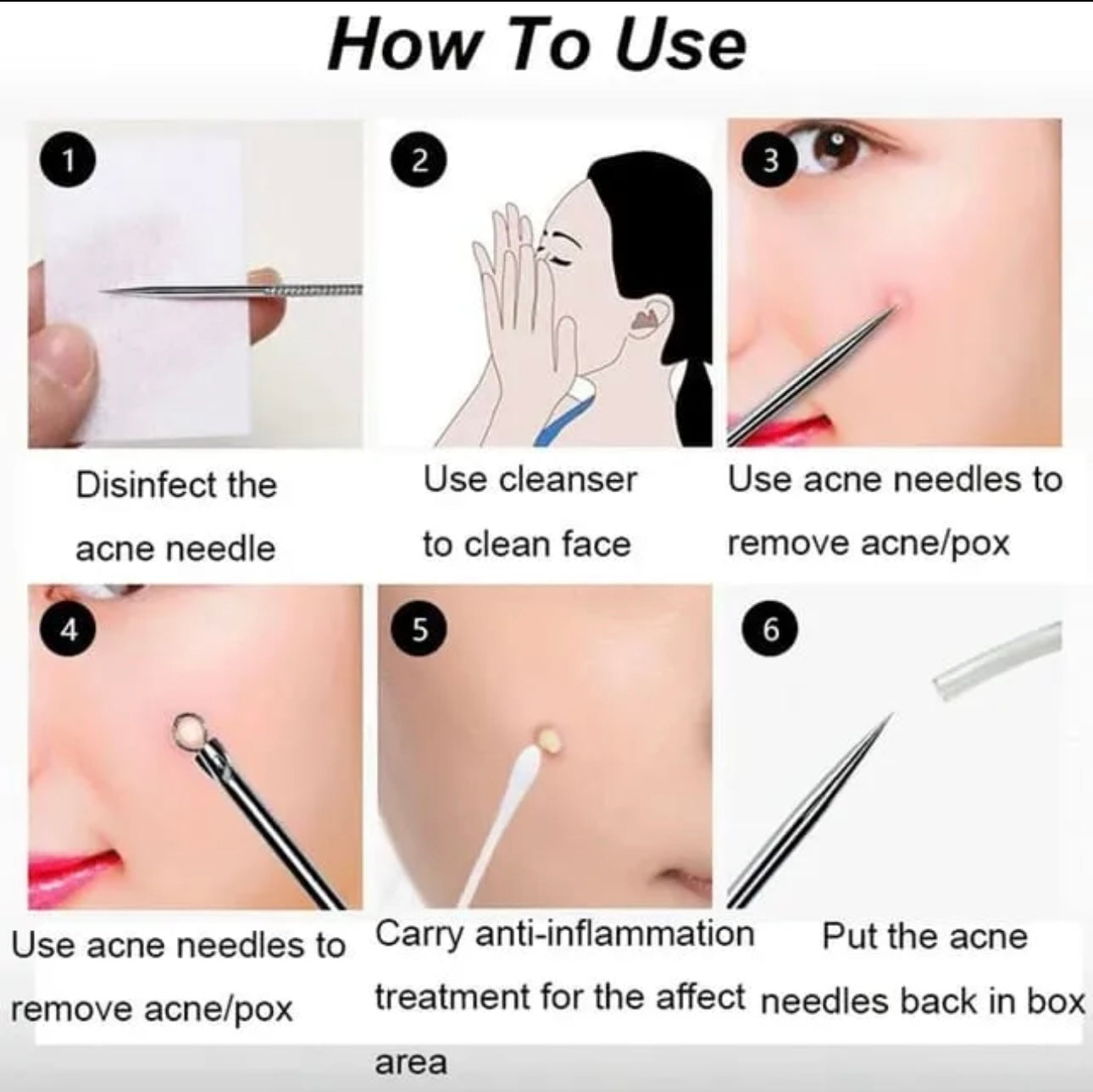 4pcs/set Dual Heads Acne Needle Blackhead Blemish Squeeze Pimple Extractor Remover Spot Cleaner Beauty Skin Care Tool Kit